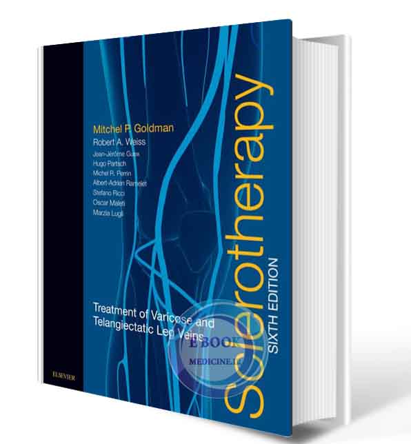 دانلود کتاب Sclerotherapy: Treatment of Varicose and Telangiectatic Leg Veins 6th 2017(ORIGINAL PDF)